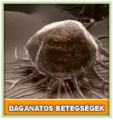 Daganatos betegségek kiegészítő kezelése